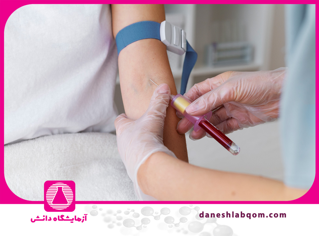 آزمایش عملکرد کلیه ( اینکه BUN و کراتینین چه چیزی نشان می‌دهند؟)