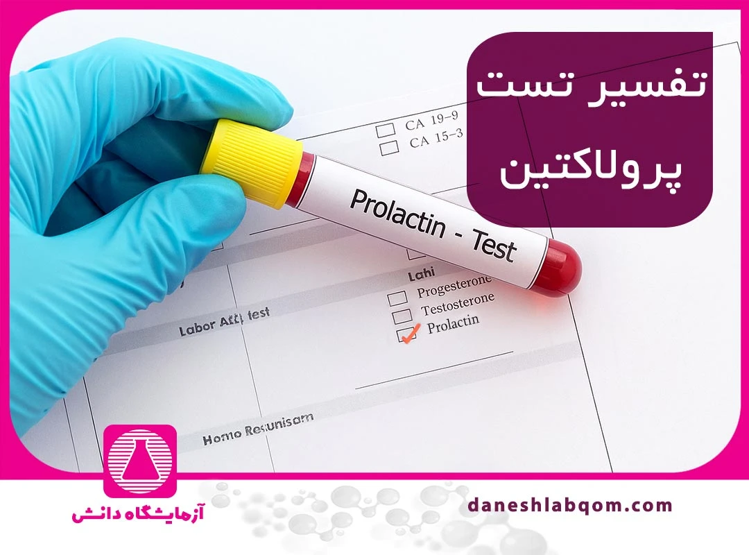 آزمایش پرولاکتین | علت انجام، شرایط قبل از تست و تفسیر نتایج