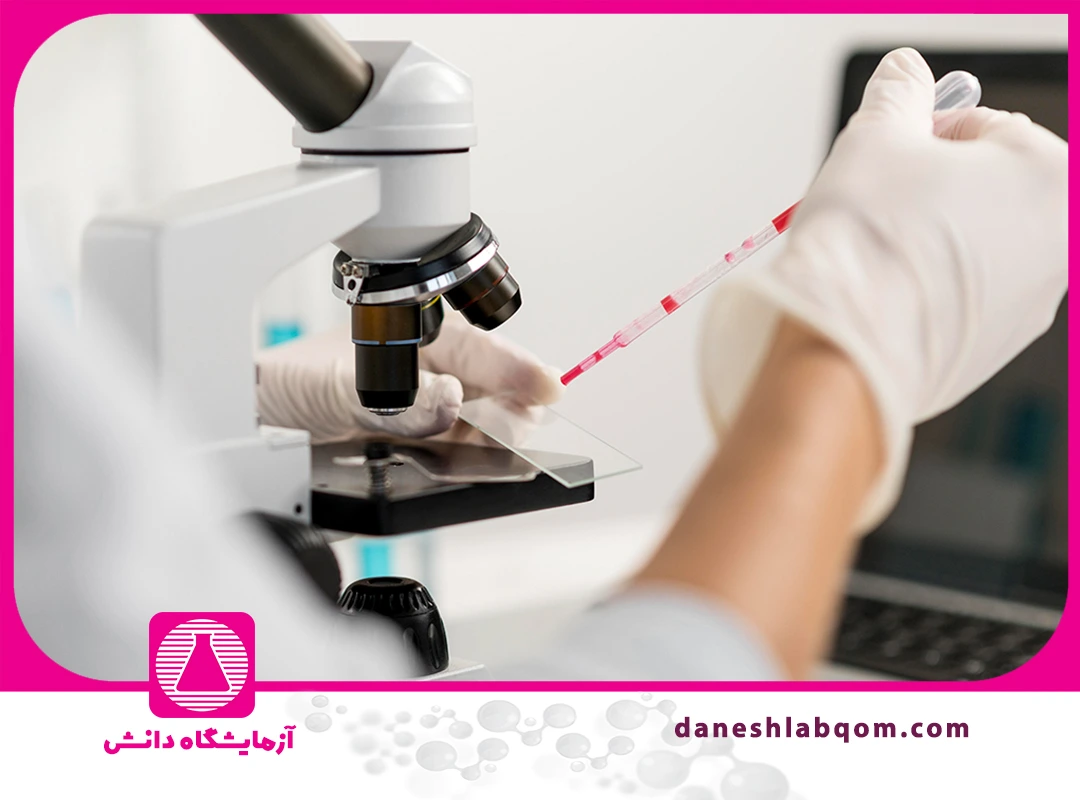 آزمایش سرطان | انواع تومور مارکرها و نحوه تفسیر نتایج