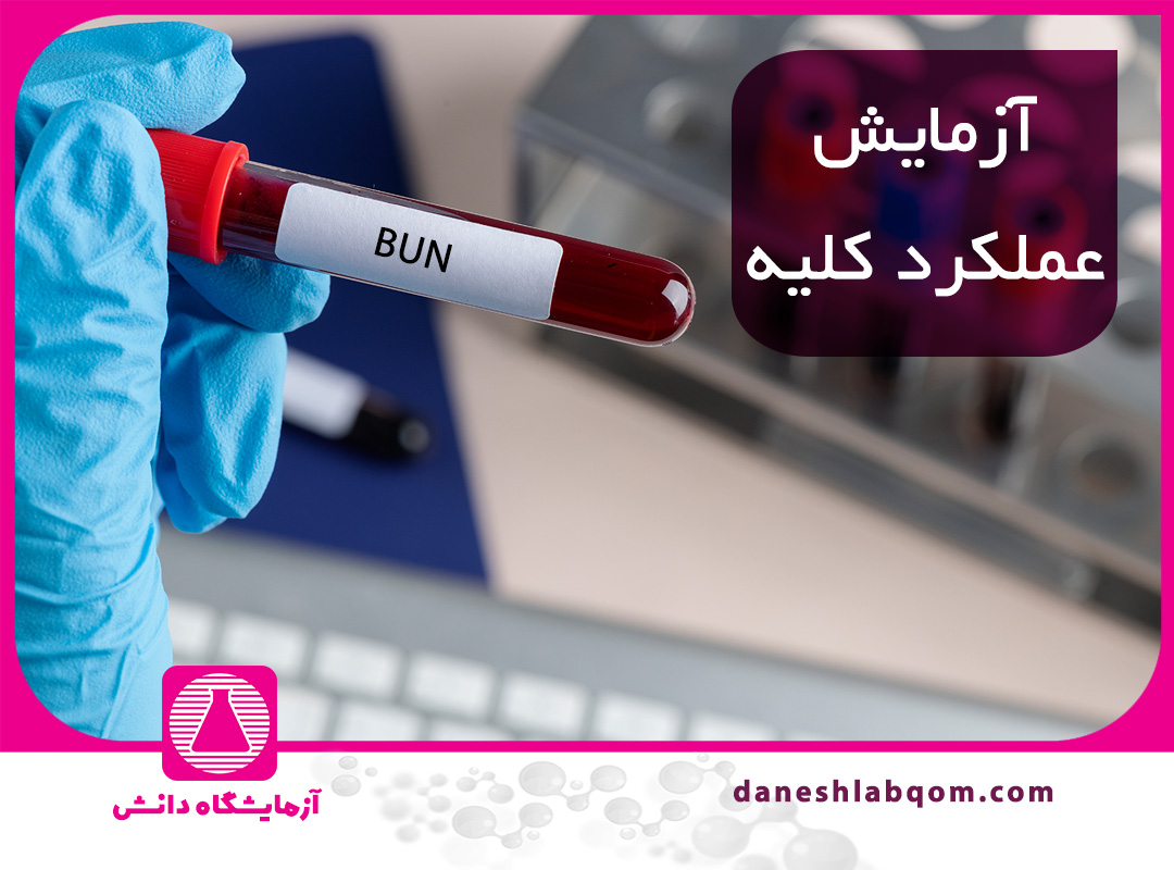 آزمایش عملکرد کلیه ( اینکه BUN و کراتینین چه چیزی نشان می‌دهند؟)