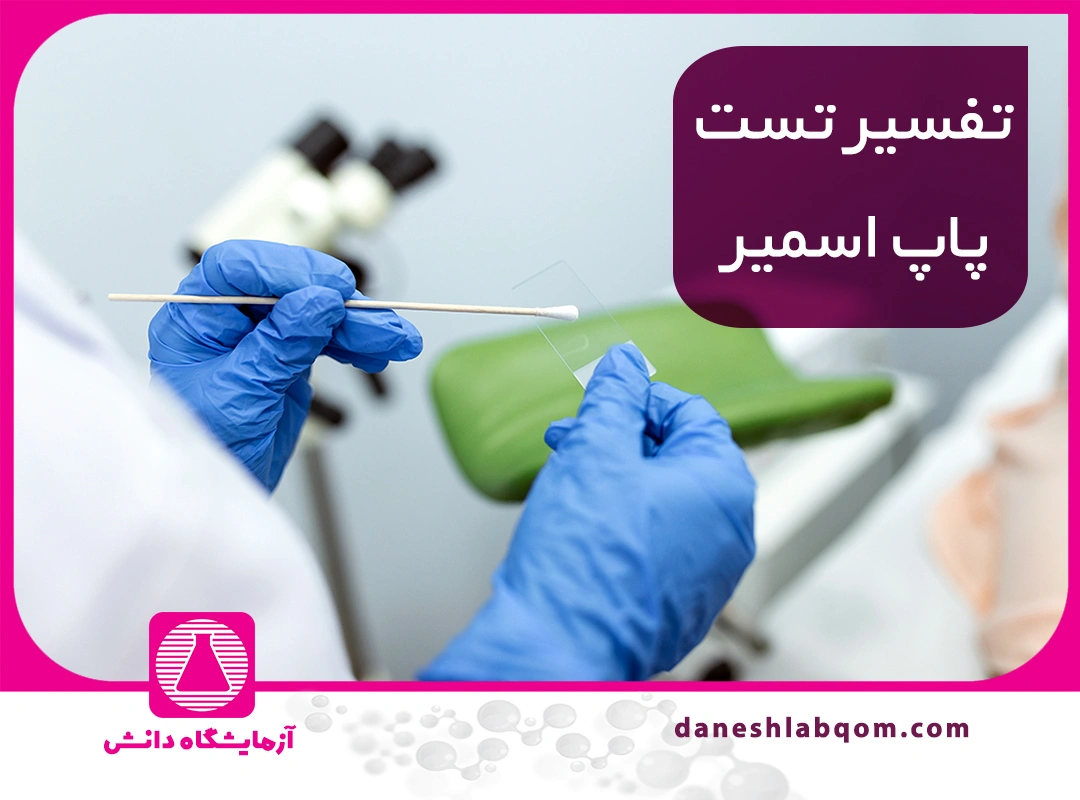 آزمایش پاپ اسمیر | روش انجام، تفسیر نتیجه و بهترین زمان برای تست