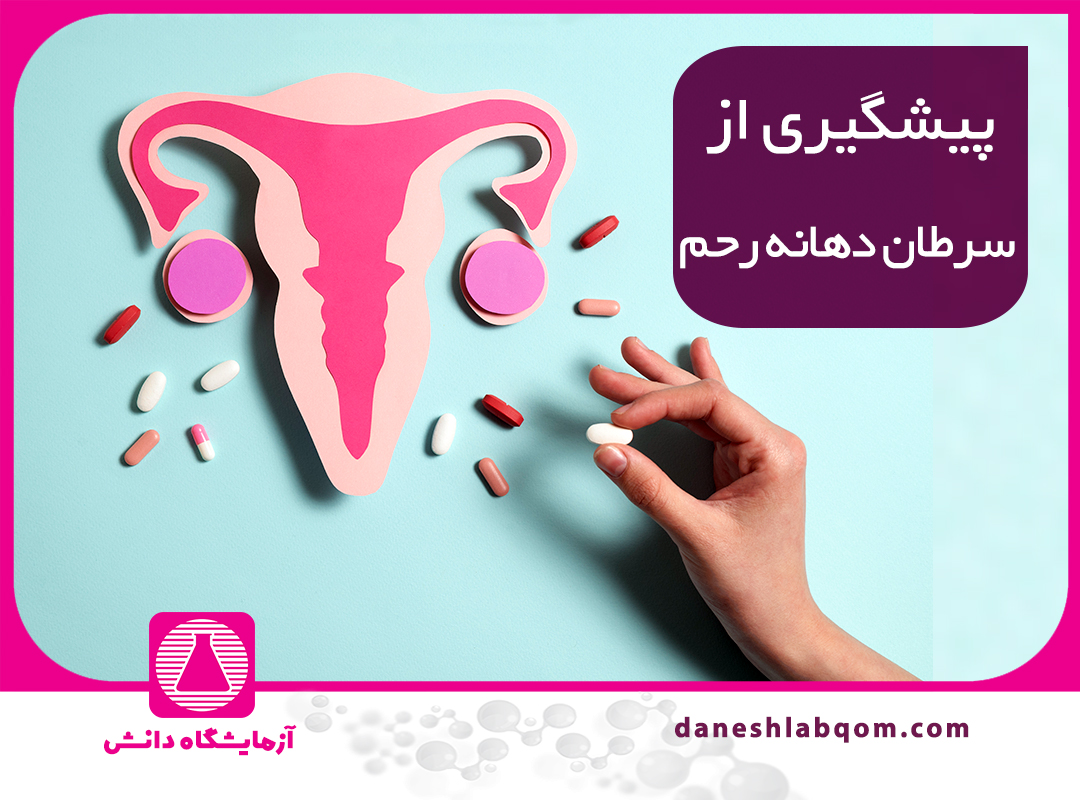 آزمایش HPV، نحوه انجام و ارتباط با سرطان دهانه رحم